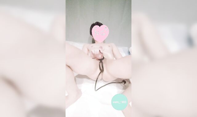 Self-widening Anani with an anal invasion foray balloon