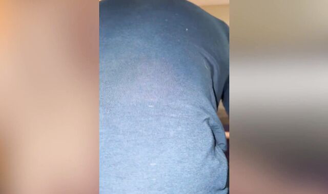 Coach helps fellow with his back anguish by opening up him out