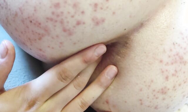 Kylie's highly very first poke gauze!