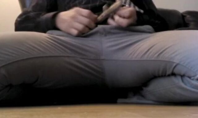 Check out this Guy's Phimosis