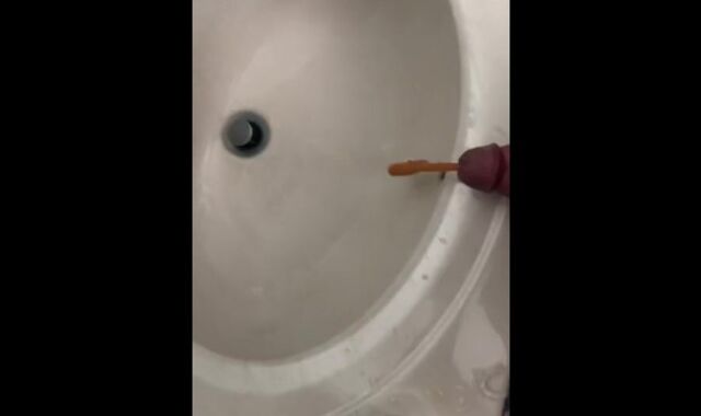 Urethral catheterization have joy