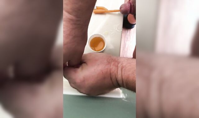 Urethral catheterization have joy