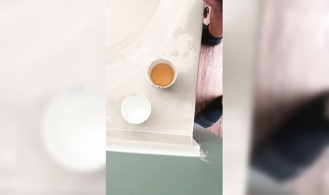 Urethral catheterization have joy