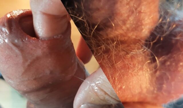 The guy jism abundantly putting his thumbs under the foreskin