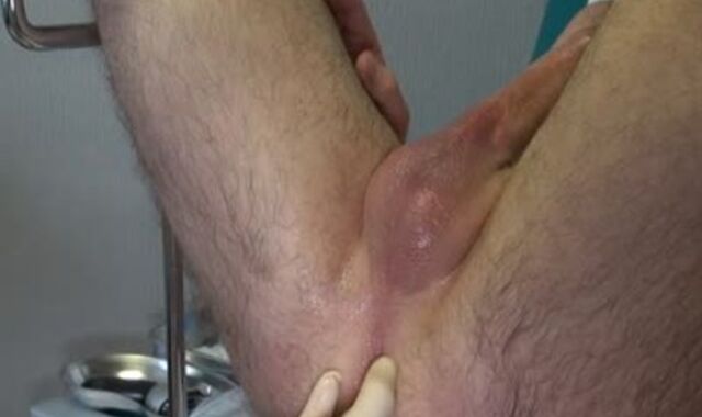 Advice And Tips On Buttfuck Or shitpipe Handballing. Do's And Don'ts. Based On Personal Experience As A Role HAVE FUN Doctor.