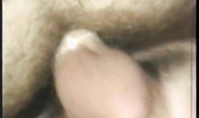 Hairline - Episode 1